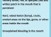 symptoms of oral cancer -- dental clinic port credit