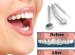 Dental Reshaping -- cosmetic dentistry Mississauga