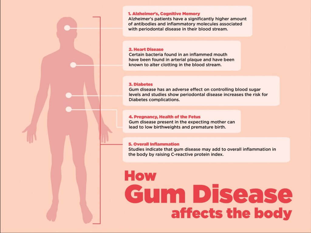 How Gum Disease Affects the Body -- dental clinic Mississauga