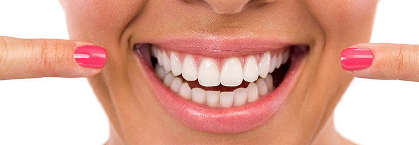 perfect teeth dental implants