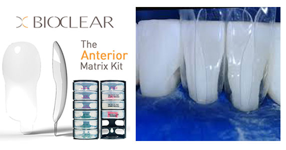 bioclear matrix