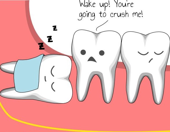 wisdom teeth extraction mississauga