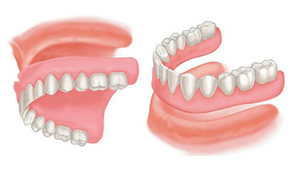 complete dentures mississauga