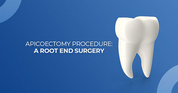 APICOECTOMY