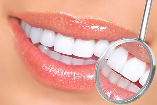 cosmetic porcelain veneers mississauga