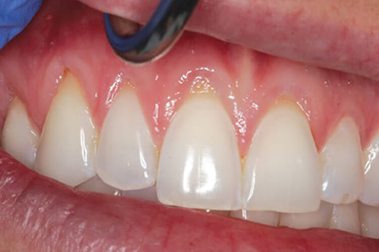 image of the teeth