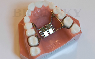 banded palatal expander