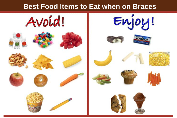 5 Foods To Avoid When You Are Wearing Braces 