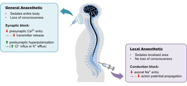 anesthesia_med