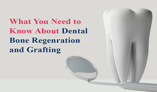 What-You-Need-to-Know-about-Dental-Bone-Regeneration-and-Grafting-compressor