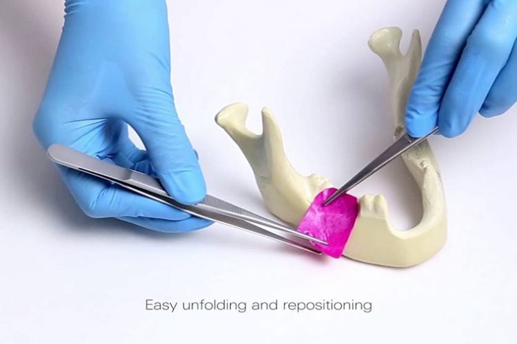 dental bone preservation