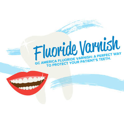fluoride varnish