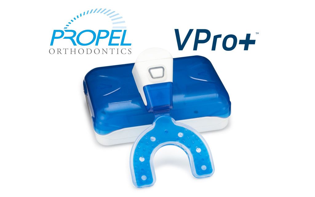 propel vpro+