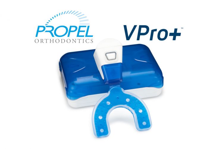 propel vpro+