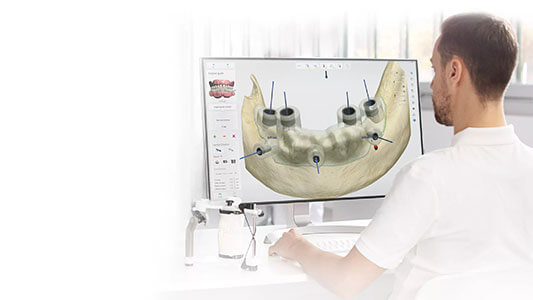 3Shape Implant Studio Guided Surgery & Dental Implant Planning Software