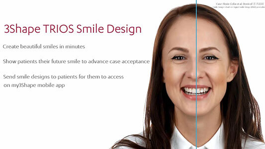 3Shape TRIOS Smile Design