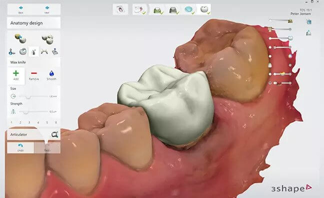 3shape trios - intraoval scanner