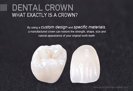 dental crowns