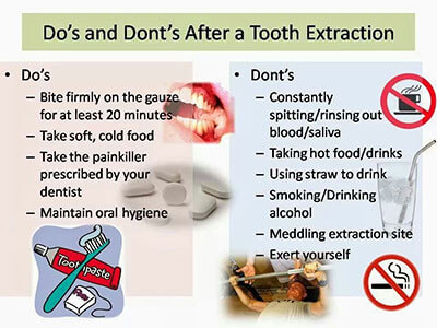 dos donts tooth extraction