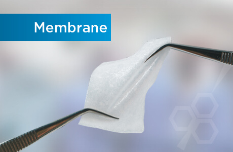 membrane