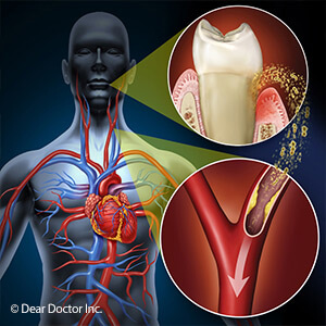 oral-systemic-health-disgram