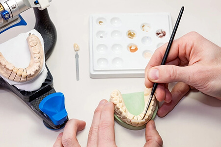 dental ceramist