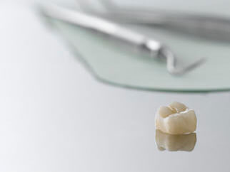 dental zirconia crowns