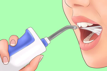 Tips for removing tonsil stones