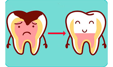 tooth before and after being fixed