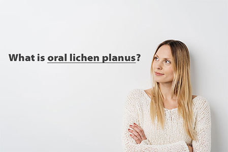 what-is-oral-lichen-planus