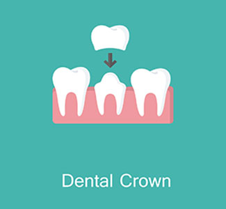 dental-crown