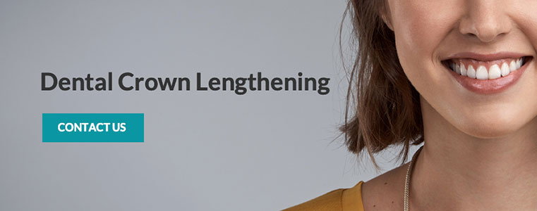 dental-crown-lengthening
