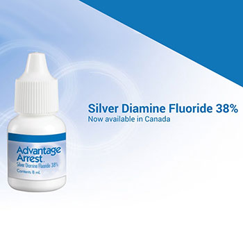 silver-diamine-fluoride-thornhill