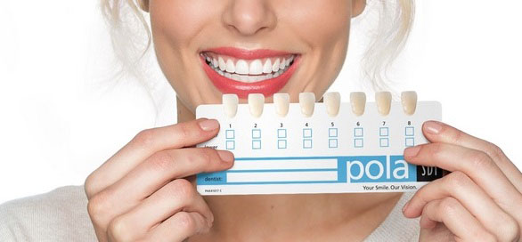teeth-whitening-Vancouver-cost