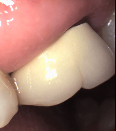 close-up image of a teeth