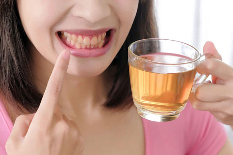 lady holding a cup of tea pointing at her stained teeth