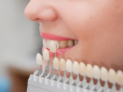 a smiling girl showing her teeth with a bunch of fake teeth with different color