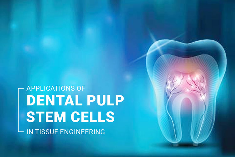 digital image of the tooth with the text dental pulp stem